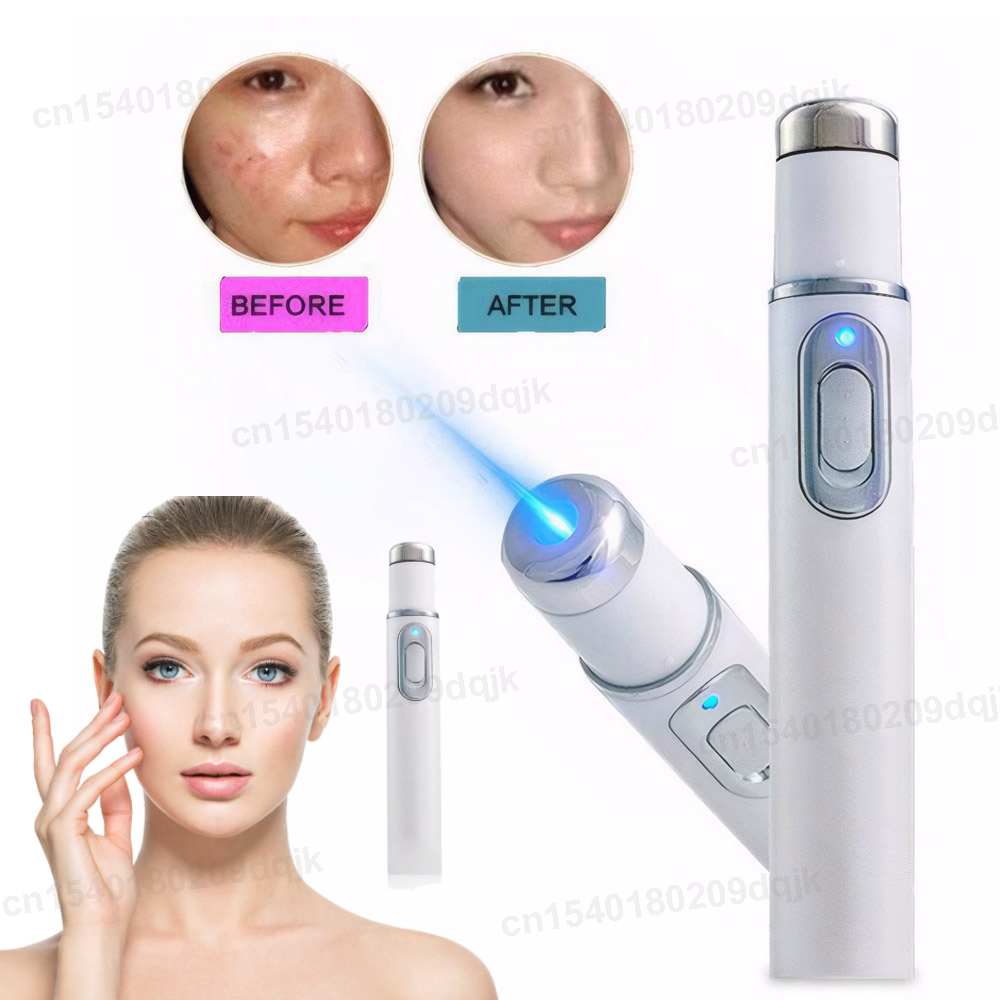 Acne Light Therapy Pen - Терапия синего света, ручка от прыщей,